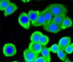 ATP Citrate Lyase Antibody in Immunocytochemistry (ICC/IF)