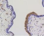 ATP Citrate Lyase Antibody in Immunohistochemistry (Paraffin) (IHC (P))