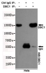 DBC1 Antibody in Immunoprecipitation (IP)