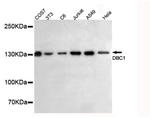 DBC1 Antibody in Western Blot (WB)