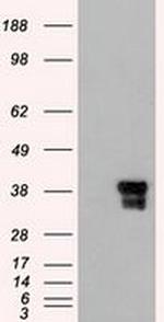 ICAD Antibody in Western Blot (WB)