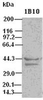 ICAD Antibody in Western Blot (WB)