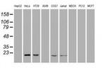 Adenylate Kinase 1 Antibody in Western Blot (WB)