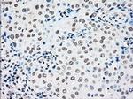 RAD9 Antibody in Immunohistochemistry (Paraffin) (IHC (P))