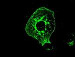 Kindlin 2 Antibody in Immunocytochemistry (ICC/IF)