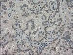 TRIB2 Antibody in Immunohistochemistry (Paraffin) (IHC (P))