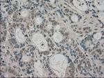 TRIB2 Antibody in Immunohistochemistry (Paraffin) (IHC (P))