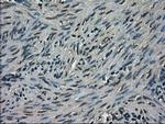 TRIB2 Antibody in Immunohistochemistry (Paraffin) (IHC (P))