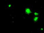 DHFR Antibody in Immunocytochemistry (ICC/IF)