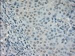 DHFR Antibody in Immunohistochemistry (Paraffin) (IHC (P))