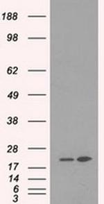 DHFR Antibody in Western Blot (WB)