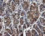 SATB1 Antibody in Immunohistochemistry (Paraffin) (IHC (P))