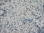 PPP1R7 Antibody in Immunohistochemistry (Paraffin) (IHC (P))