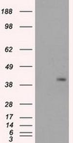 PPP1R7 Antibody in Western Blot (WB)