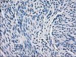 BCKDK Antibody in Immunohistochemistry (Paraffin) (IHC (P))