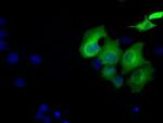 Sorbitol Dehydrogenase Antibody in Immunocytochemistry (ICC/IF)