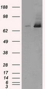 TTLL12 Antibody in Western Blot (WB)