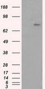 PTPRE Antibody in Western Blot (WB)