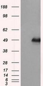 DAPK2 Antibody in Western Blot (WB)