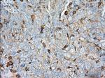 ALDH3A1 Antibody in Immunohistochemistry (Paraffin) (IHC (P))