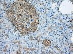 ALDH3A1 Antibody in Immunohistochemistry (Paraffin) (IHC (P))