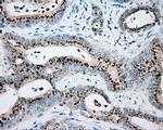 VAT1L Antibody in Immunohistochemistry (Paraffin) (IHC (P))