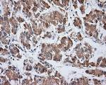 VAT1L Antibody in Immunohistochemistry (Paraffin) (IHC (P))