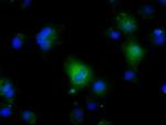 NIT2 Antibody in Immunocytochemistry (ICC/IF)