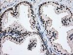 H6PD Antibody in Immunohistochemistry (Paraffin) (IHC (P))