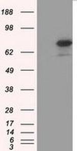 H6PD Antibody in Western Blot (WB)