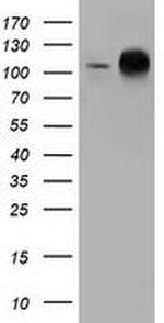 TACC3 Antibody in Western Blot (WB)