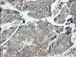 BDH2 Antibody in Immunohistochemistry (Paraffin) (IHC (P))