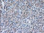 SNX9 Antibody in Immunohistochemistry (Paraffin) (IHC (P))