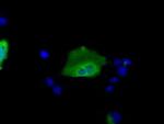 SNX9 Antibody in Immunocytochemistry (ICC/IF)