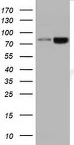 DGKB Antibody in Western Blot (WB)