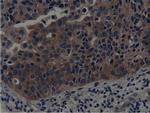 SH3GL1 Antibody in Immunohistochemistry (Paraffin) (IHC (P))