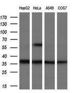 UCK1 Antibody in Western Blot (WB)