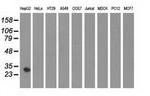 SULT2A1 Antibody in Western Blot (WB)