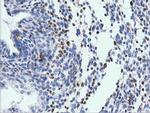 ARHGAP25 Antibody in Immunohistochemistry (Paraffin) (IHC (P))