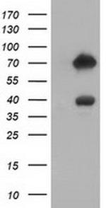 ARHGAP25 Antibody in Western Blot (WB)