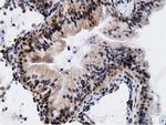 EPM2AIP1 Antibody in Immunohistochemistry (Paraffin) (IHC (P))