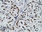 EPM2AIP1 Antibody in Immunohistochemistry (Paraffin) (IHC (P))