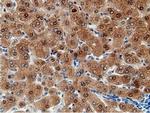 EPM2AIP1 Antibody in Immunohistochemistry (Paraffin) (IHC (P))