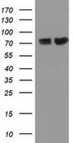PUS7 Antibody in Western Blot (WB)