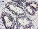 Adenylate Kinase 3 Antibody in Immunohistochemistry (Paraffin) (IHC (P))