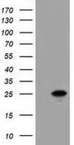 Adenylate Kinase 3 Antibody in Western Blot (WB)