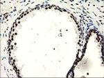 SULT1A1 Antibody in Immunohistochemistry (Paraffin) (IHC (P))