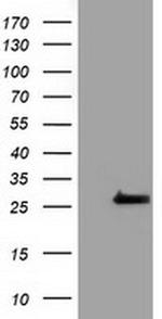 OTUB2 Antibody in Western Blot (WB)