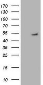 GSS Antibody in Western Blot (WB)