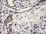 CTDSP1 Antibody in Immunohistochemistry (Paraffin) (IHC (P))